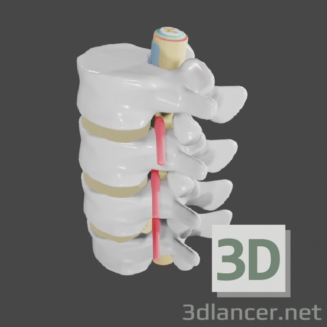 Protrusion und Hernie in der Lendenwirbelsäule 3D-Modell kaufen - Rendern