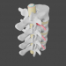 Protrusion und Hernie in der Lendenwirbelsäule 3D-Modell kaufen - Rendern