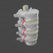 Protrusion und Hernie in der Lendenwirbelsäule 3D-Modell kaufen - Rendern