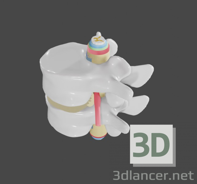 modello 3D di Ernia intervertebrale nella colonna lombare comprare - rendering